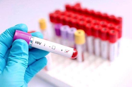 女病人移植幹細胞後體內 HIV 消失