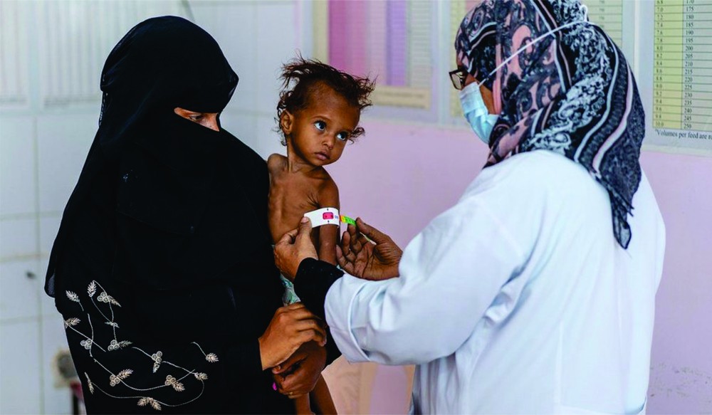 一歲多女孩在也門一家醫院接受營養不良治療。（圖：互聯網）