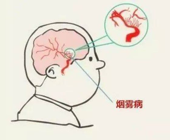 年轻人头晕=没休息好?