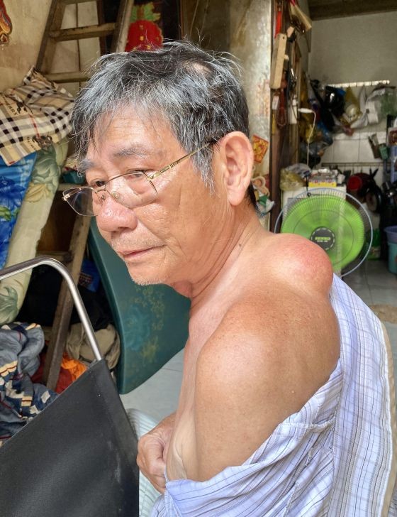 老汉盼早施手术