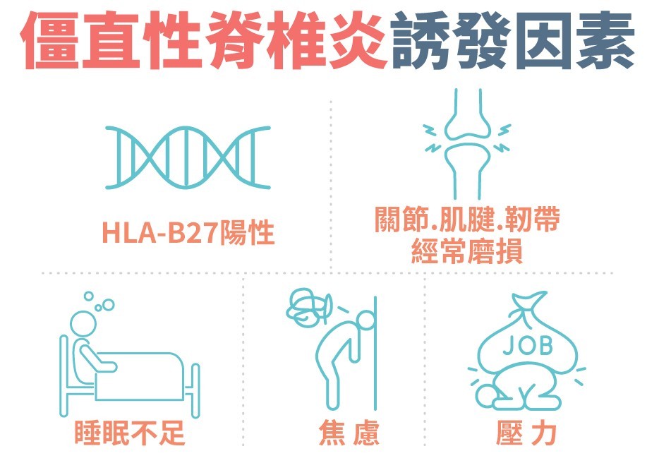 僵直性脊椎炎不只下背痛！