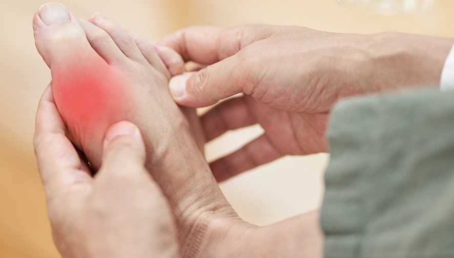 大鱼大肉不断 当心“痛风”找上门！