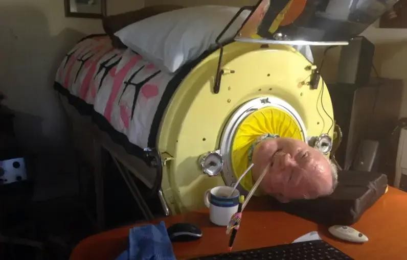 美国德克萨斯州男子亚历山大小时候患上脊髓灰质炎（poliomyelitis），在“铁肺”里生活了逾70年。他于星期一（3月11日）离世，终年78岁。（图：互联网）