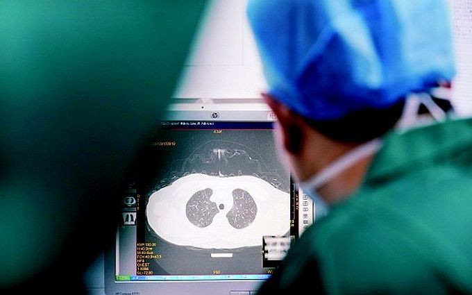 医生在查看患者肺部CT片,研究治疗方案。 (新华社资料图)