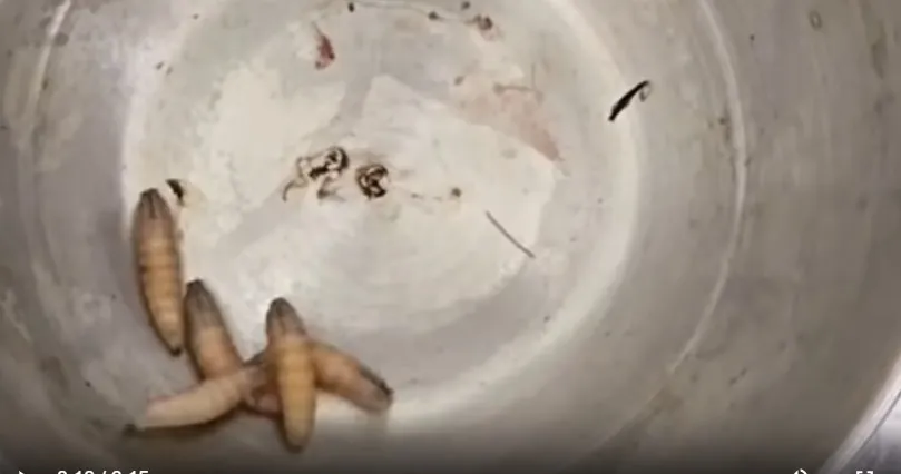 5 con giòi trong tai bệnh nhân. Ảnh cắt từ video của Bệnh viện đa khoa Khánh Hòa gioi.jpg