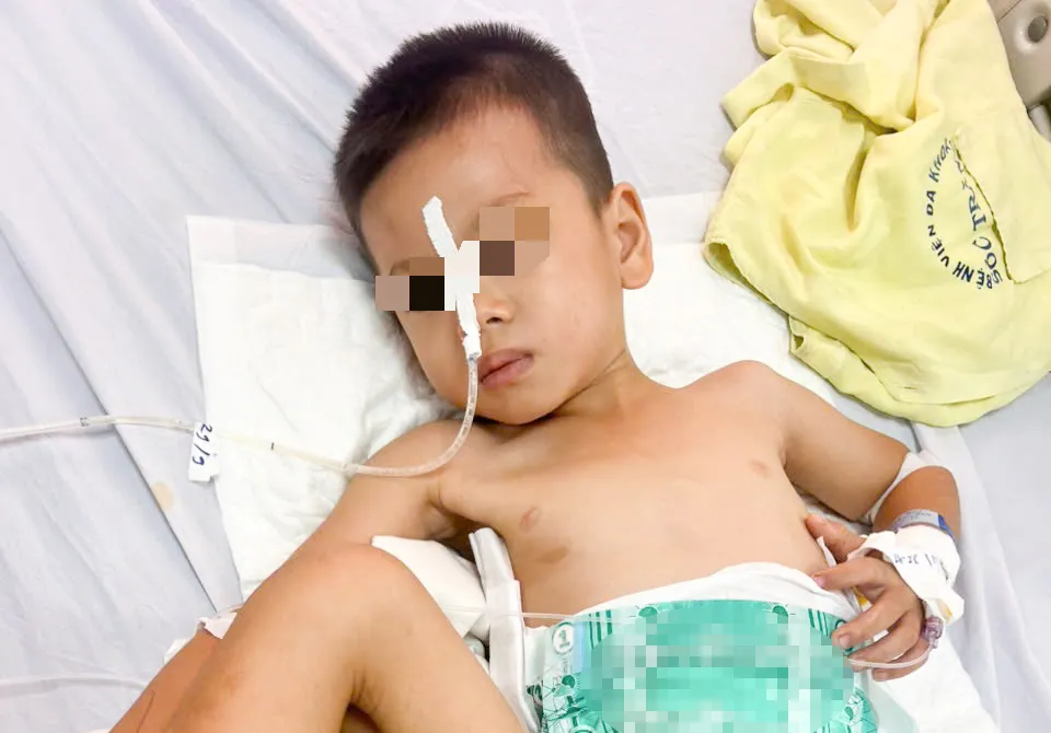 Sức khỏe bé trai 4 tuổi sau phẫu thuật diễn tiến tốt be 4 tuoi hieulungjpg.jpg