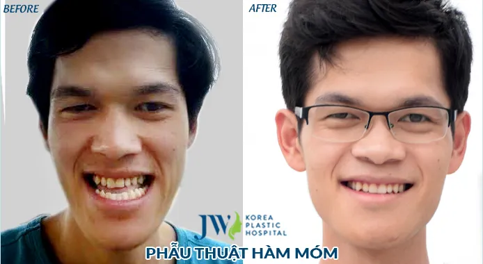 Hướng đi mới trong phẫu thuật tạo hình ảnh 1