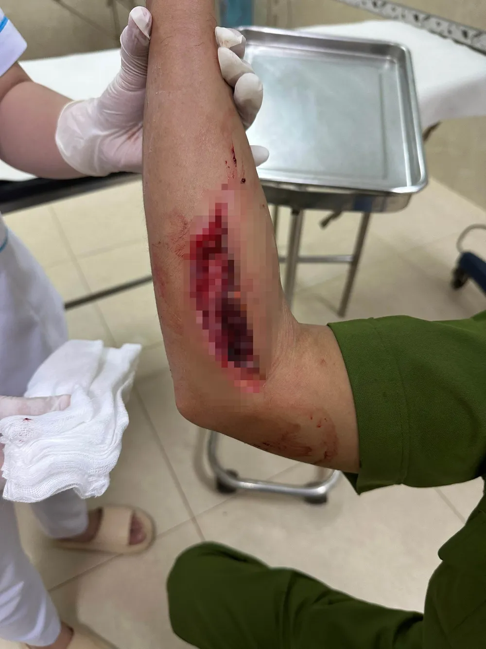 Trung tá Nguyễn Đắc Thủy bị thương sau khi bị người vi phạm nồng độ cồn tông phải