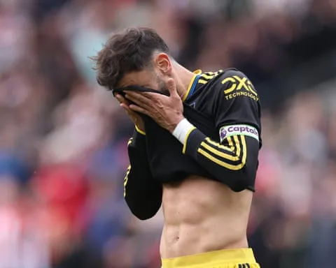 Fernandes che đầu bằng tay sau khi phạt đền bị cản phá.