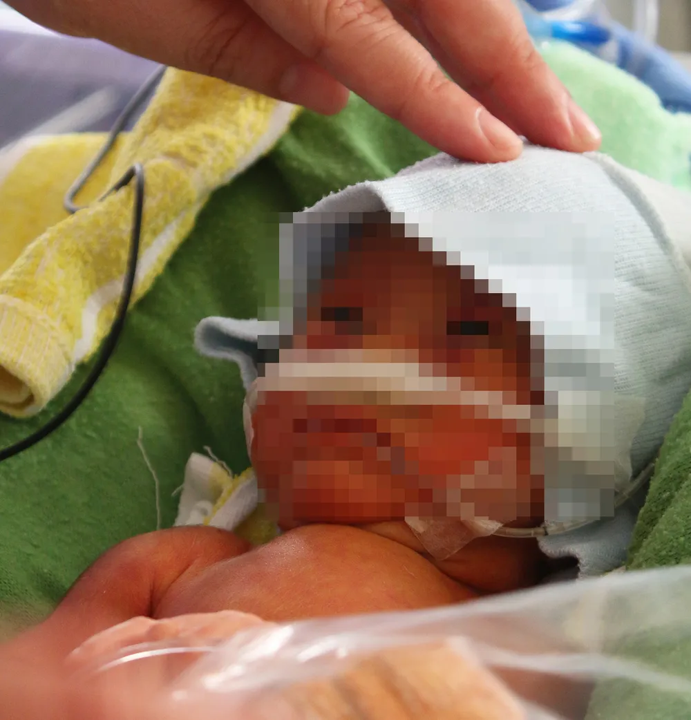 “Cái ôm đầu tiên” - Hướng tới 4 triệu trẻ sơ sinh tiếp theo ảnh 2