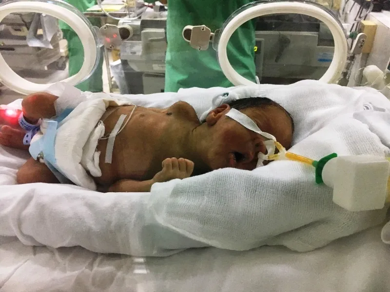 Nỗ lực hết tâm sức để hai mẹ con sản phụ mắc ung thư sớm được gặp nhau ảnh 3 Nỗ lực hết tâm sức để hai mẹ con sản phụ mắc ung thư sớm được gặp nhau ảnh 3