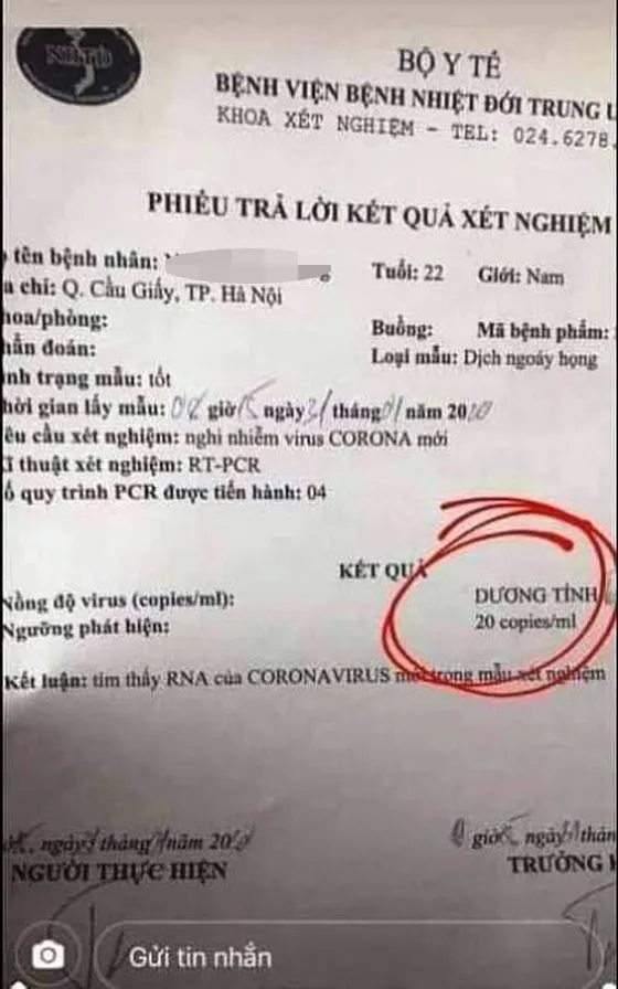 Cả gan làm giả kết quả xét nghiệm virus Corona ảnh 1 Cả gan làm giả kết quả xét nghiệm virus Corona ảnh 1