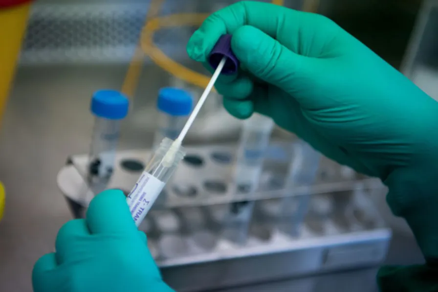 Nuôi cấy phân lập virus SARS-CoV-2 trong phòng thí nghiệm Nuôi cấy phân lập virus SARS-CoV-2 trong phòng thí nghiệm