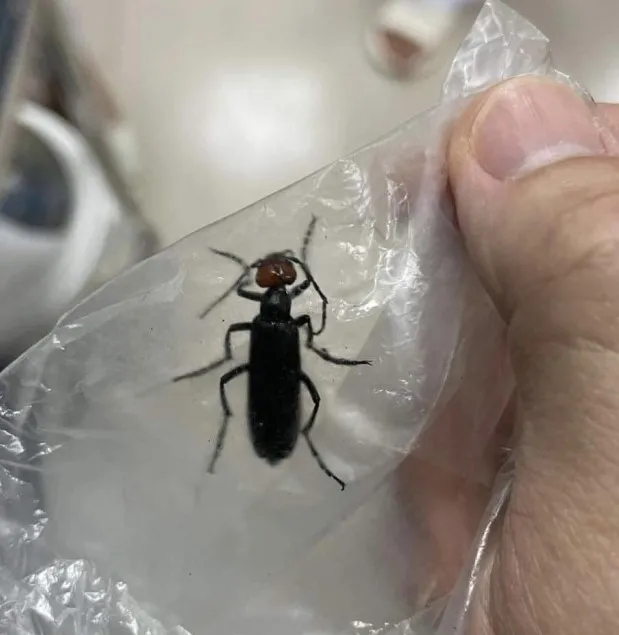 Hình ảnh sâu ban miêu được người nhà bệnh nhân cung cấp cho bác sĩ Hình ảnh sâu ban miêu được người nhà bệnh nhân cung cấp cho bác sĩ