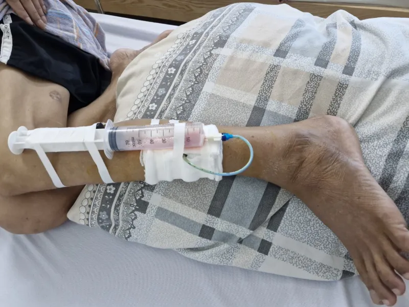 Vi khuẩn Burkholderia pseudomallei thường xâm nhập vào cơ thể người qua vết thương hở ở chân 1.jpg