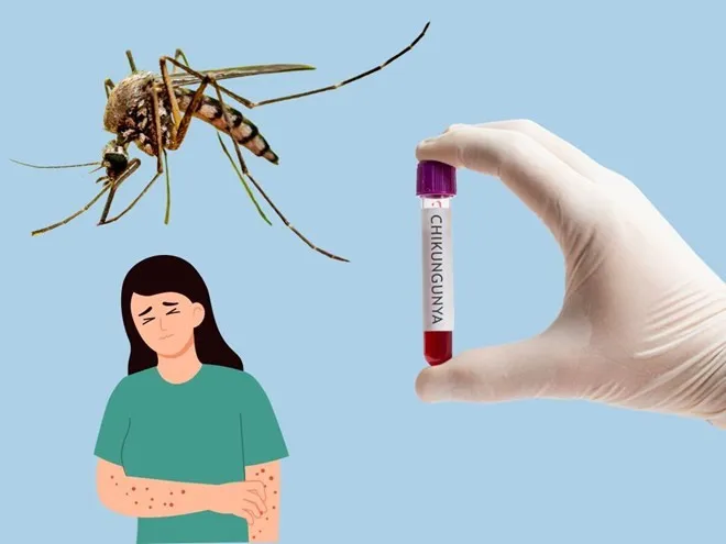 Dịch bệnh Chikungunya lây truyền sang người qua muỗi Aedes đốt 2392460_4de745e59c1f95e393a288665a0878a7.jpg