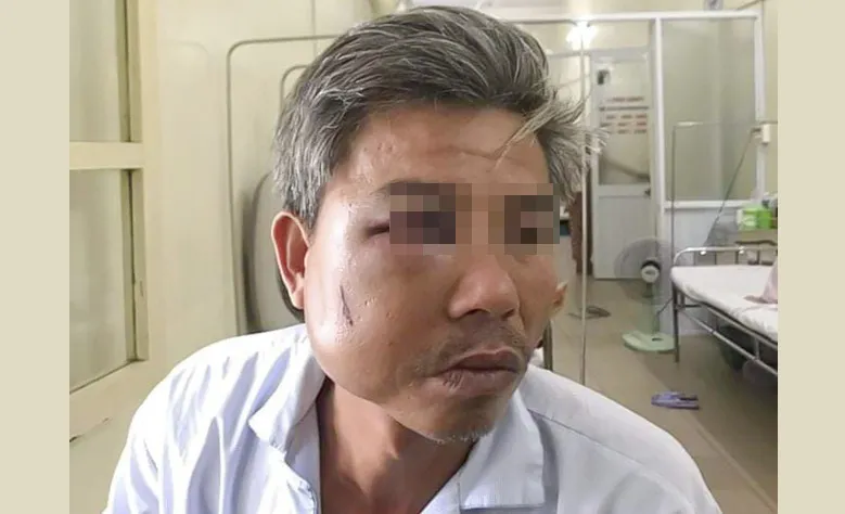 Khởi tố chủ quán cà phê Bố Già đánh trọng thương công nhân cây xanh  ảnh 1