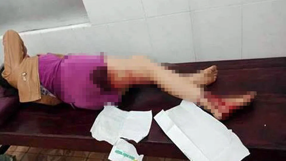 Chị Ng.Th.Th.H. thời điểm bị thương phải nhập viện