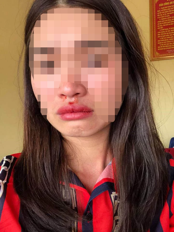 Vụ nữ hành khách tố bị hành hung ở Hà Tĩnh: Xác định xe “dù” nhái xe buýt ảnh 2 Vụ nữ hành khách tố bị hành hung ở Hà Tĩnh: Xác định xe “dù” nhái xe buýt ảnh 2