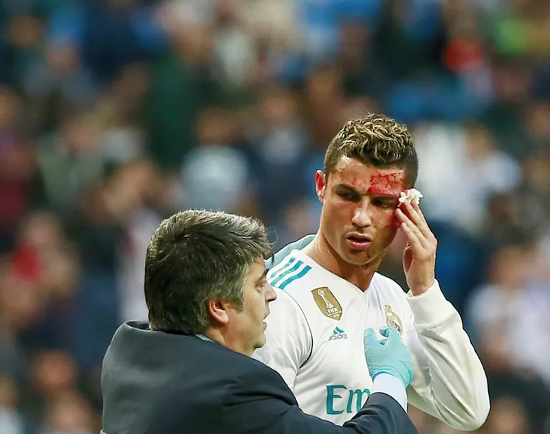 Ronaldo đổ máu vì dính gầm giày đối phương. Ảnh: Getty Images