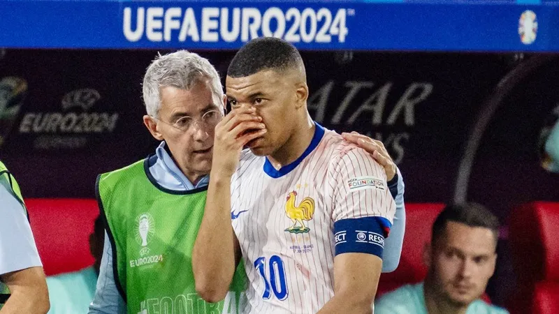 Kylian Mbappe may mắn không cần phẫu thuật mũi và có thể tiếp tục với Euro 2024.