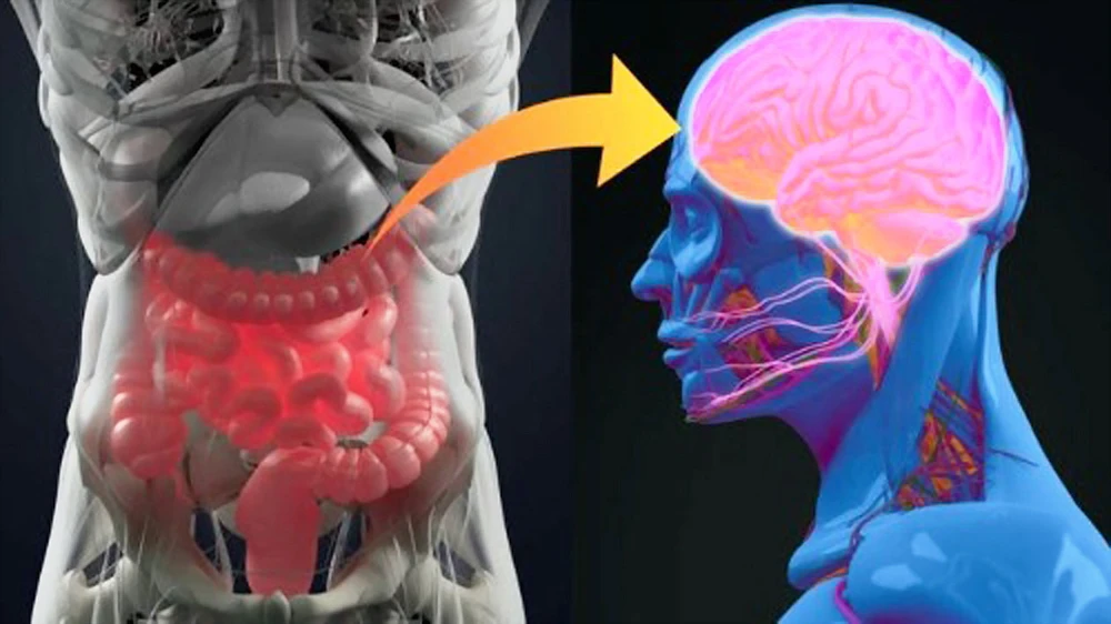 Bệnh Parkinson có thể bắt nguồn từ ruột thừa