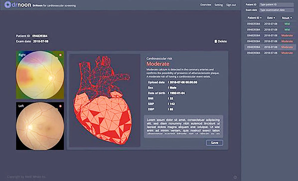 Dùng AI chẩn đoán bệnh về mắt, tim mạch