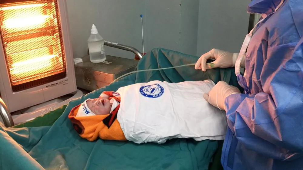 Mổ bắt con thành công cho bệnh nhân bị khó thở do hẹp khít khí quản ảnh 3