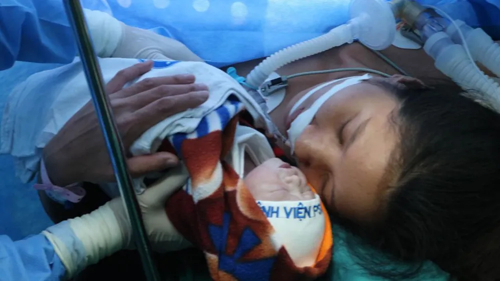 Mổ bắt con thành công cho bệnh nhân bị khó thở do hẹp khít khí quản ảnh 2