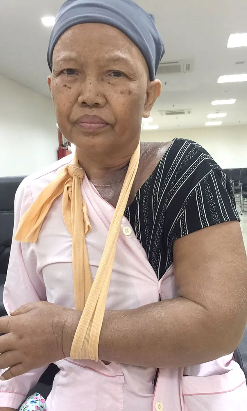 3 mẹ con nghèo mắc bệnh ung thư ảnh 1