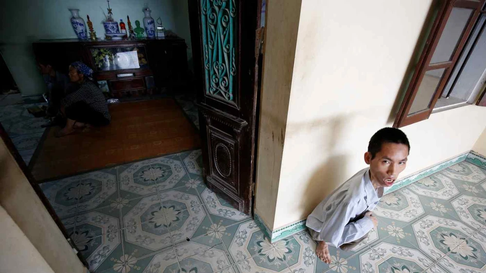 A 41-year-old man who was exposed to Agent Orange, pictured at his house in Bac Ninh province in August 2018: time is running out for Vietnamese victims. © Reuters