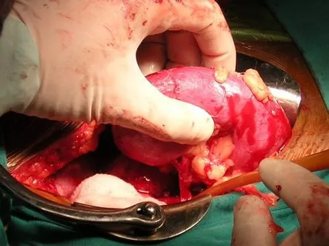 Làm rõ việc “cò” mua bán thận ở TPHCM ảnh 1