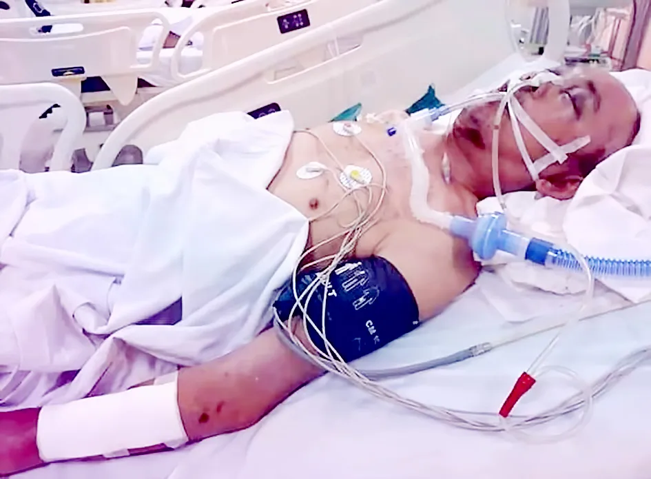 Người đàn ông trụ cột gia đình nghèo đang nguy kịch ảnh 1