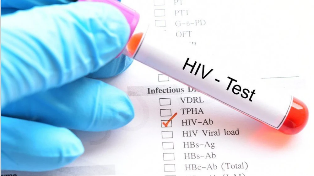 Đột phá trong điều trị HIV/AIDS