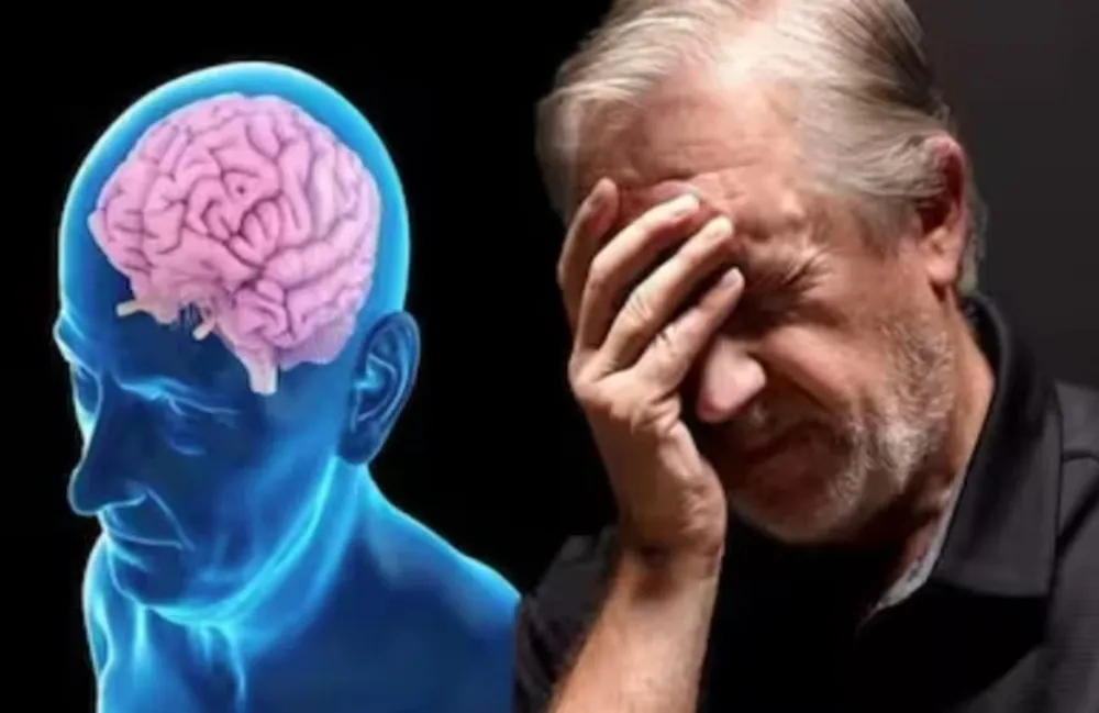 Minh họa về bệnh Alzheimer. Ảnh: THE HEALTH