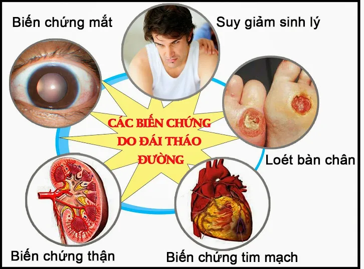 Một số bệnh thường gặp ở người cao tuổi và biện pháp phòng bệnh ảnh 4 Một số bệnh thường gặp ở người cao tuổi và biện pháp phòng bệnh ảnh 4