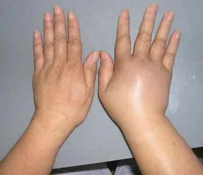 Dấu hiệu cảnh báo mắc bệnh tim mạch ảnh 1 Dấu hiệu cảnh báo mắc bệnh tim mạch ảnh 1