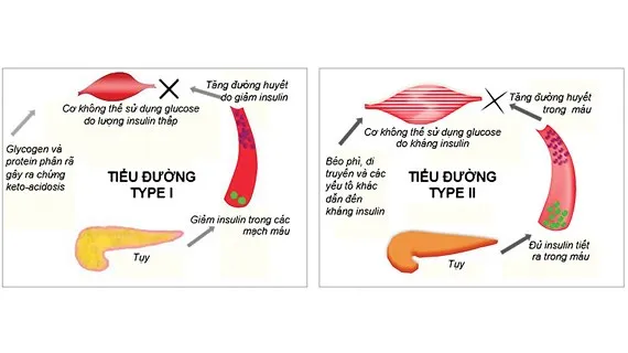 Phòng bệnh tiểu đường