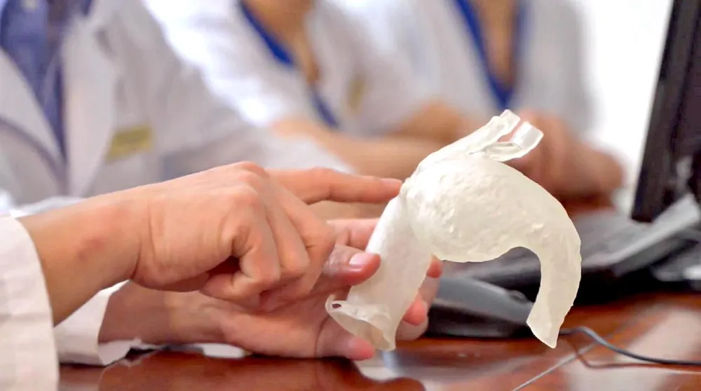 Mô hình quả tim in 3D với kích thước và tổn thương động mạch giống hoàn toàn thực tế.