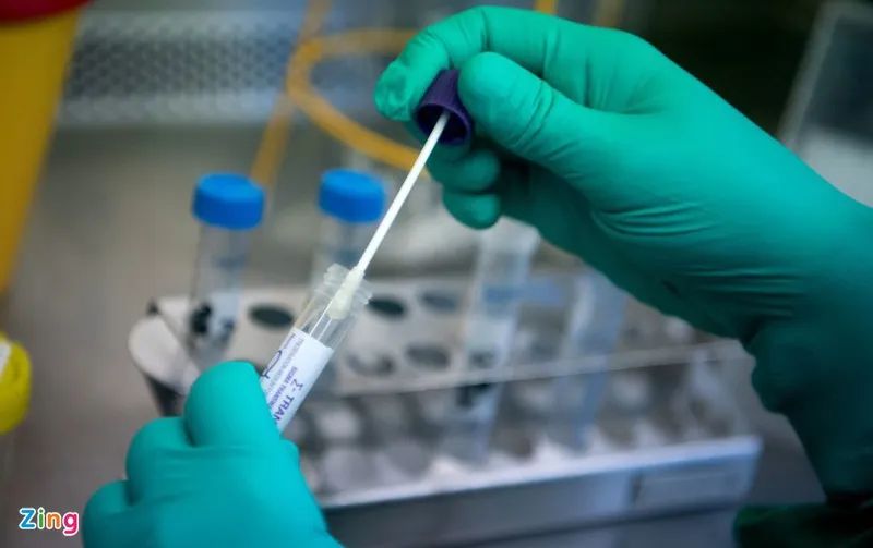 Đề xuất đưa kit xét nghiệm Covid-19 vào diện bình ổn giá ảnh 1 De xuat dua kit xet nghiem Covid-19 vao dien binh on gia anh 1