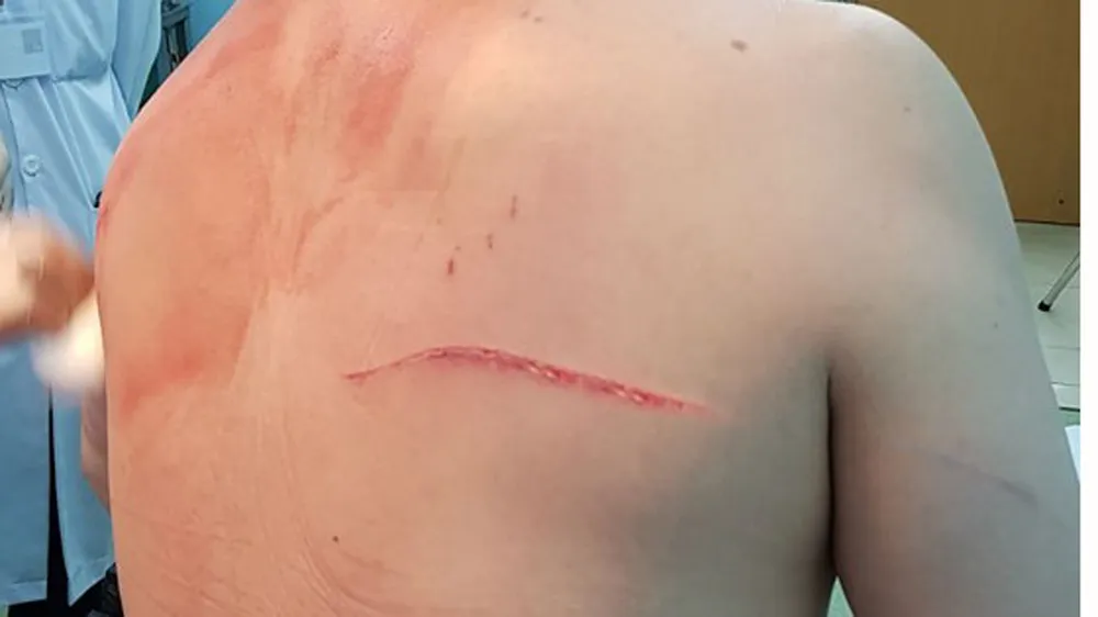 Trả hồ sơ, điều tra bổ sung vụ bác sĩ Chiêm Quốc Thái ảnh 2