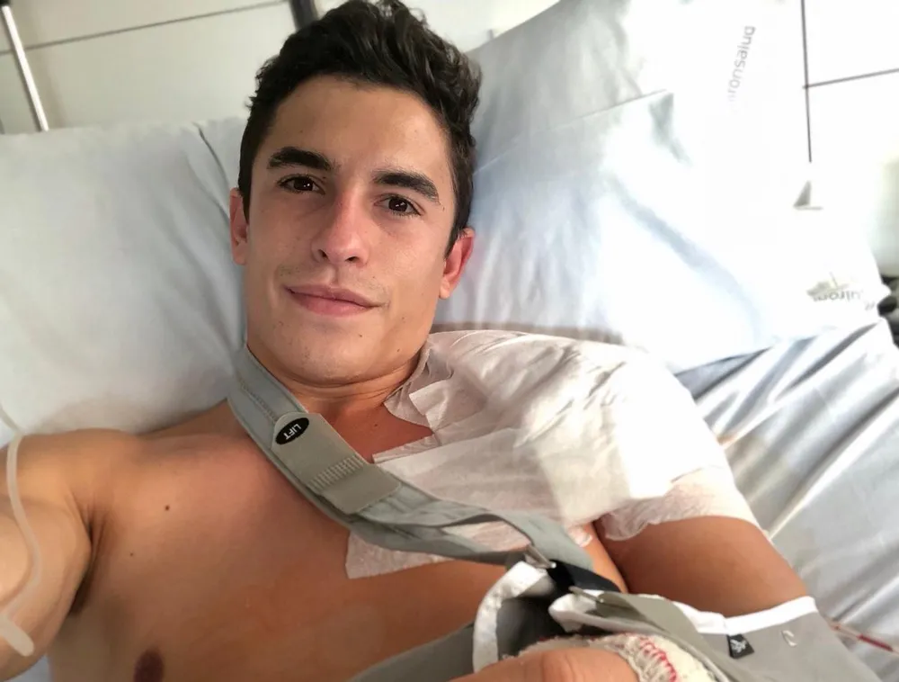 Đua xe mô tô: Quá trình hồi phục của Marquez phải đến hết mùa Đông ảnh 1