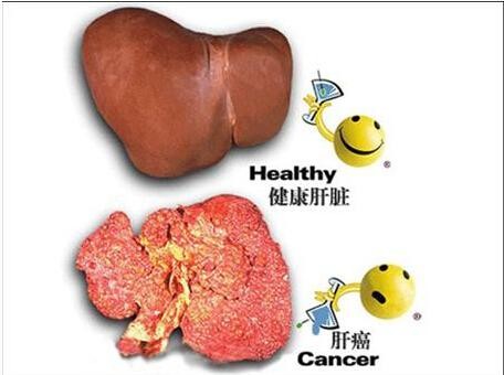 示意圖。（圖片來源：互聯網）