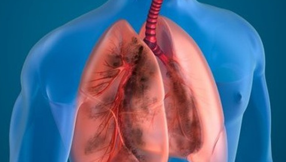 （示意圖源：互聯網）