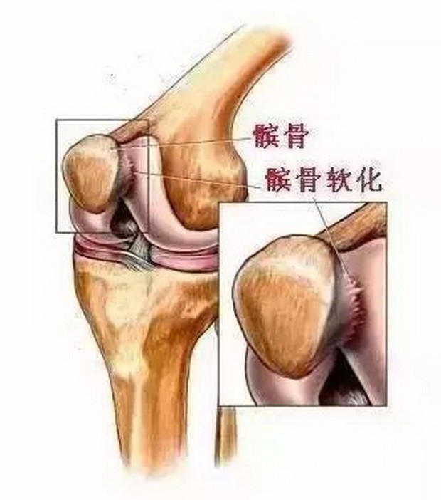 (圖源:互聯網)