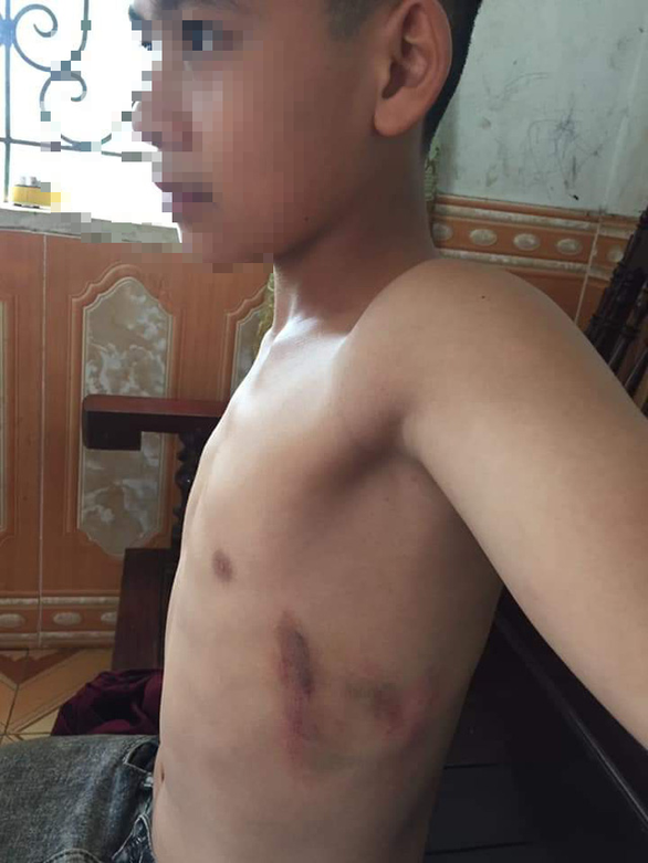 七年級B班的黎俊英