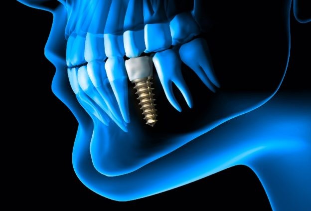 （圖源：互聯網）