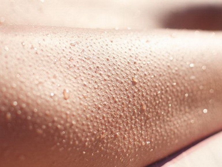 惱人的雞皮膚到底是什麼？ ảnh 1