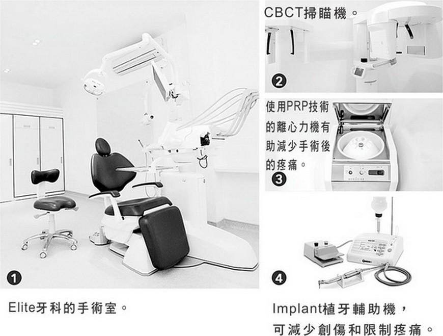 牙齒掉落帶來後果與最佳治療法 ảnh 1