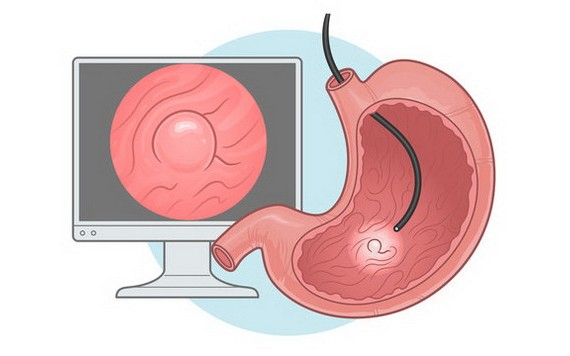 （示意圖源：互聯網） 